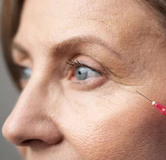 Anti wrinkle injections price in London