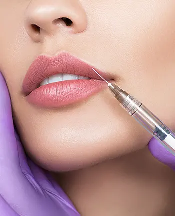 Lip Fillers London Cost UK