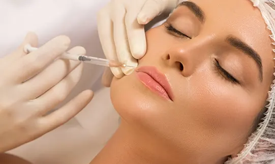 Nasolabial Folds With Dermal Fillers